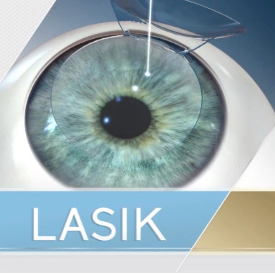 lasik video preview