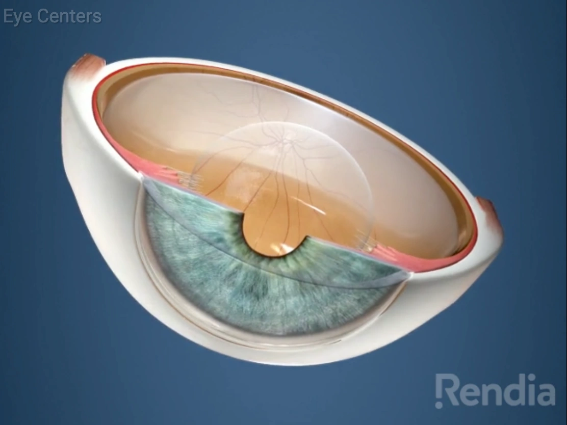 5 corneal layers video thumbnail