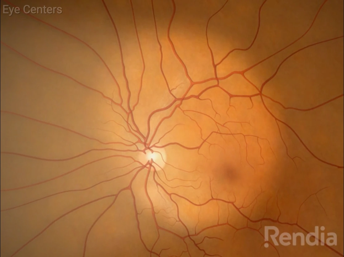 retina video