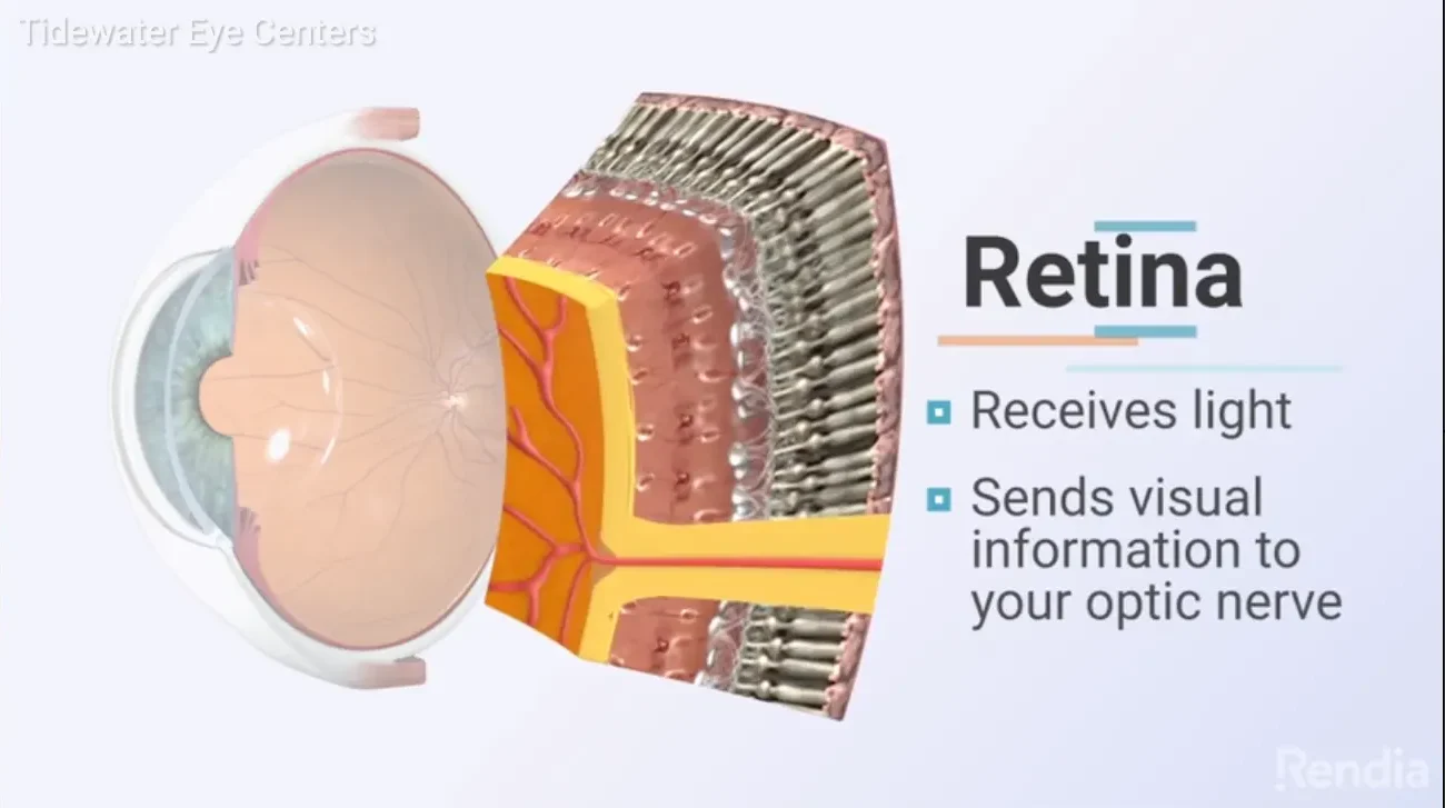 retinal detachment video preview